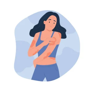 Allergy Care