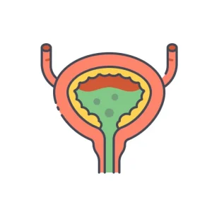 Bladder Cancer