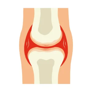 Bone & Joint Health