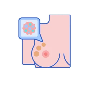 Breast Cancer