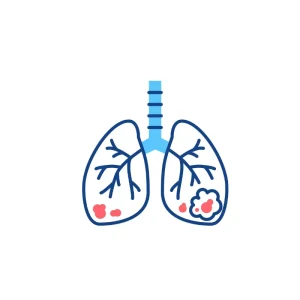 Lung Cancer
