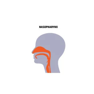 Nasopharyngeal Carcinoma