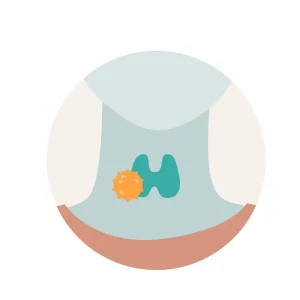 Thyroid Cancer