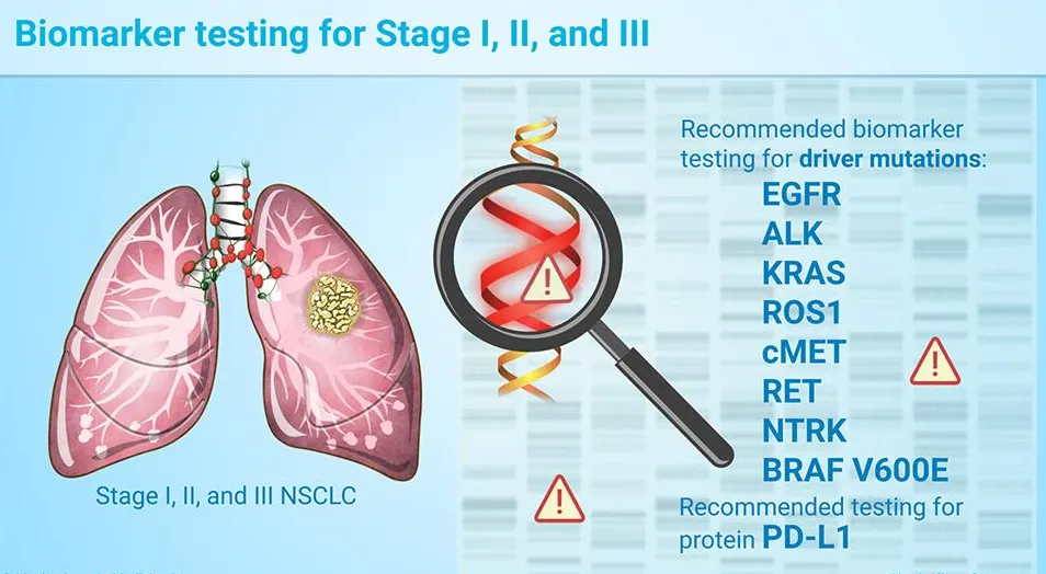 Biomarker testing for Stage I, II, and III