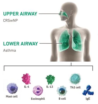 CRSwNP ← TSLP → Severe Asthma