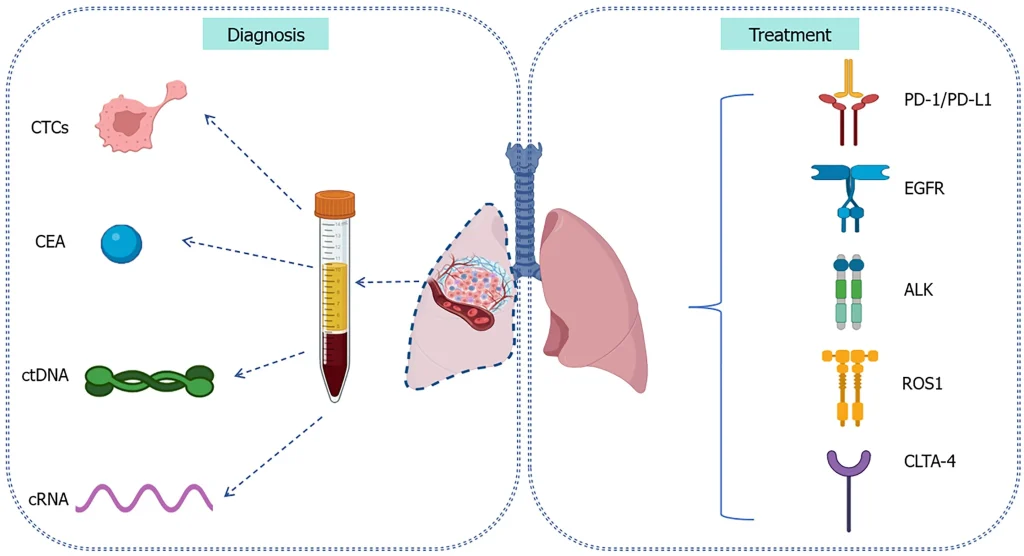 Diagnosis and Treatment
