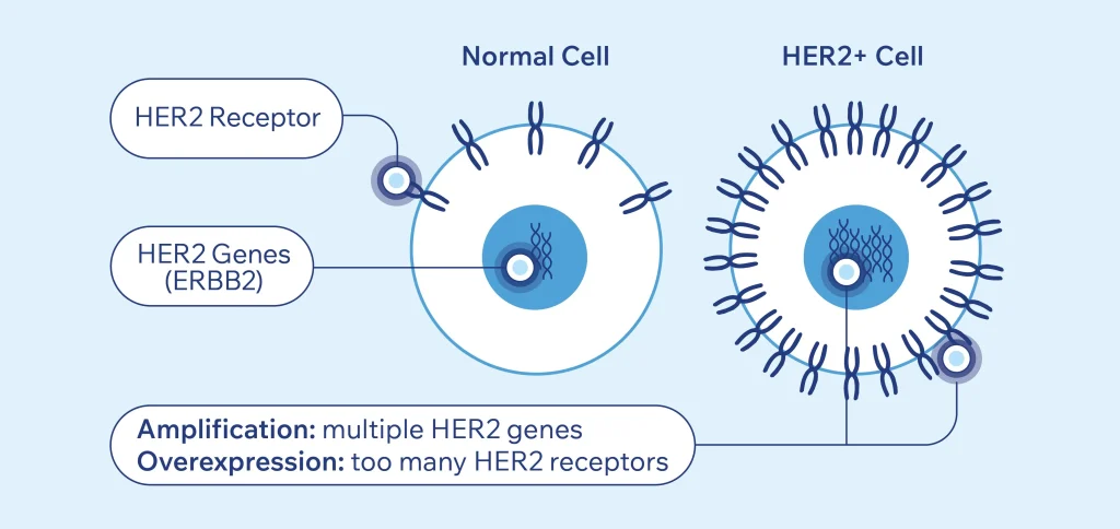 HER2 Receptor Expression
