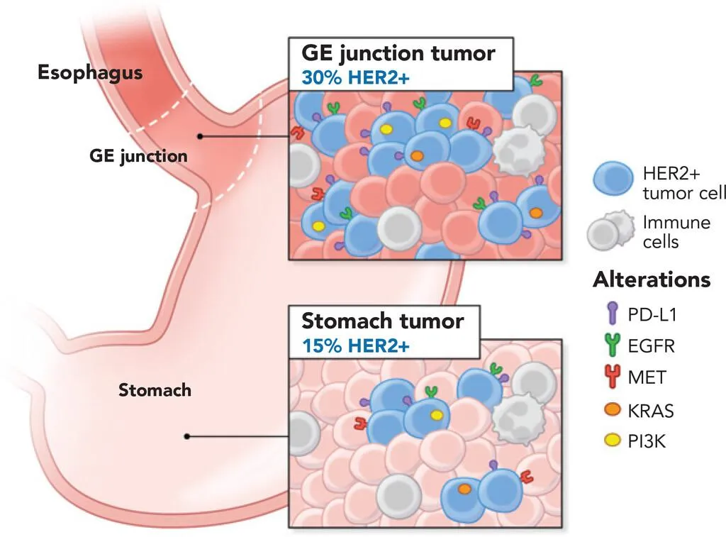 Mechanisms of Treatment for Gastric and Esophageal Cancer